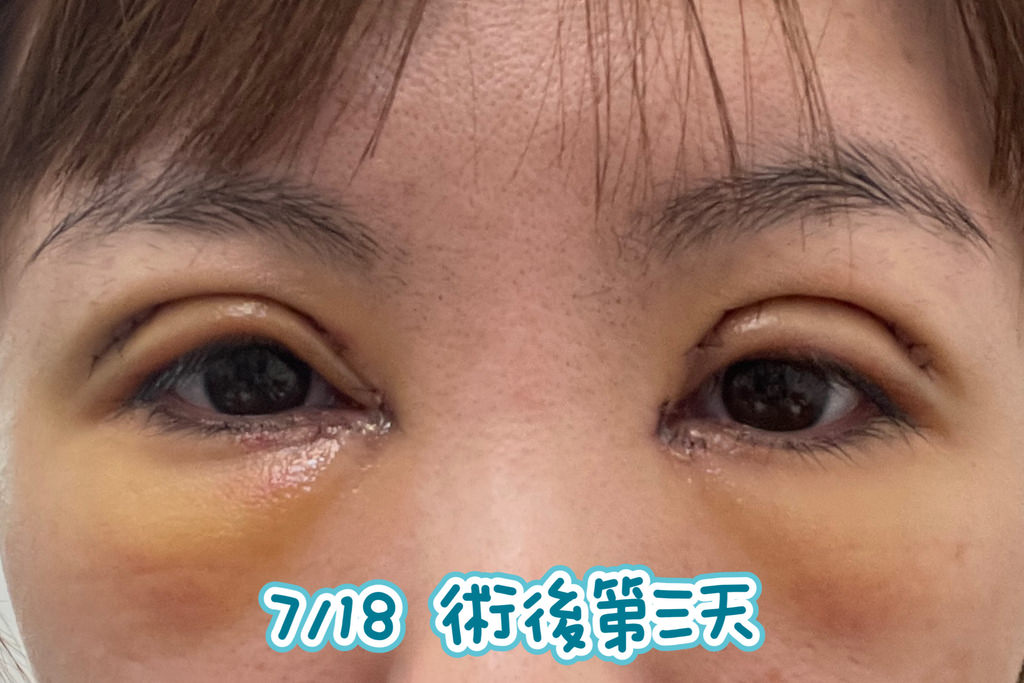 0C7FA4DD-ED1B-4D56-AC51-A7E6B7E45BF7.JPG