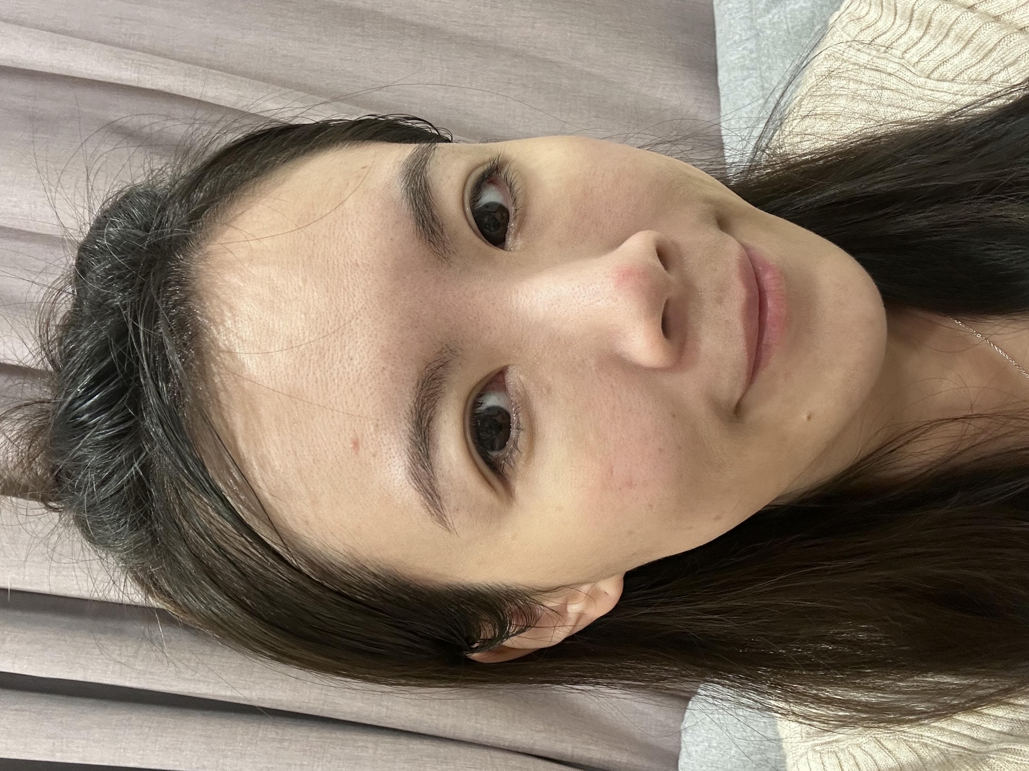 【高雄肌膚管理】麗晶診所|ExoMuse 繆斯外泌體保養品&提可塑Tixel,吸收翻倍 膚況提升好有感 - 第20張圖