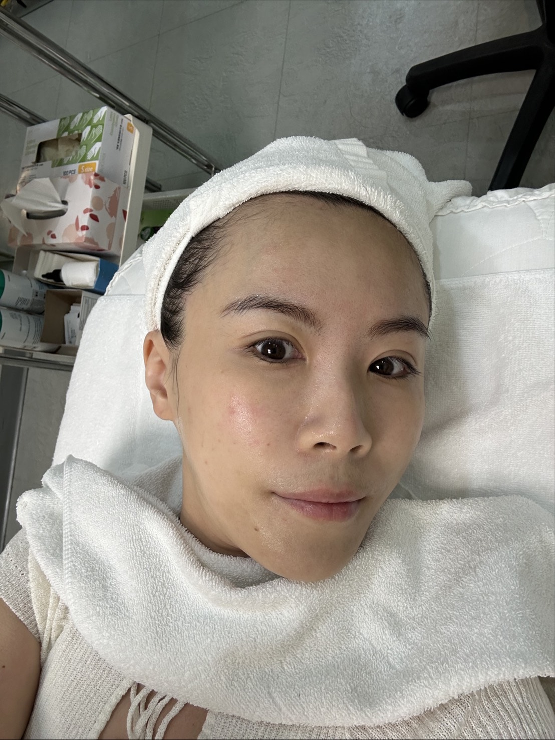 【高雄肌膚管理】麗晶診所|ExoMuse 繆斯外泌體保養品&提可塑Tixel,吸收翻倍 膚況提升好有感 - 第18張圖