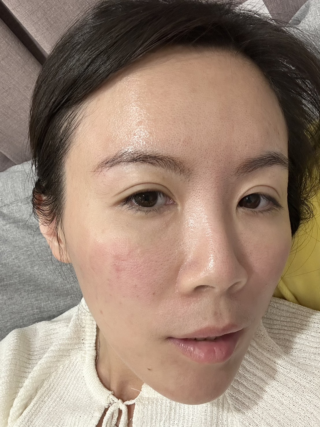 【高雄肌膚管理】麗晶診所|ExoMuse 繆斯外泌體保養品&提可塑Tixel,吸收翻倍 膚況提升好有感 - 第17張圖