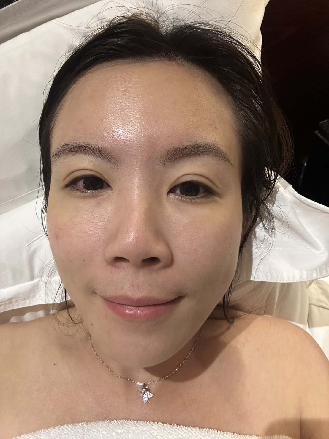 【高雄肌膚管理】麗晶診所|ExoMuse 繆斯外泌體保養品&提可塑Tixel,吸收翻倍 膚況提升好有感 - 第25張圖